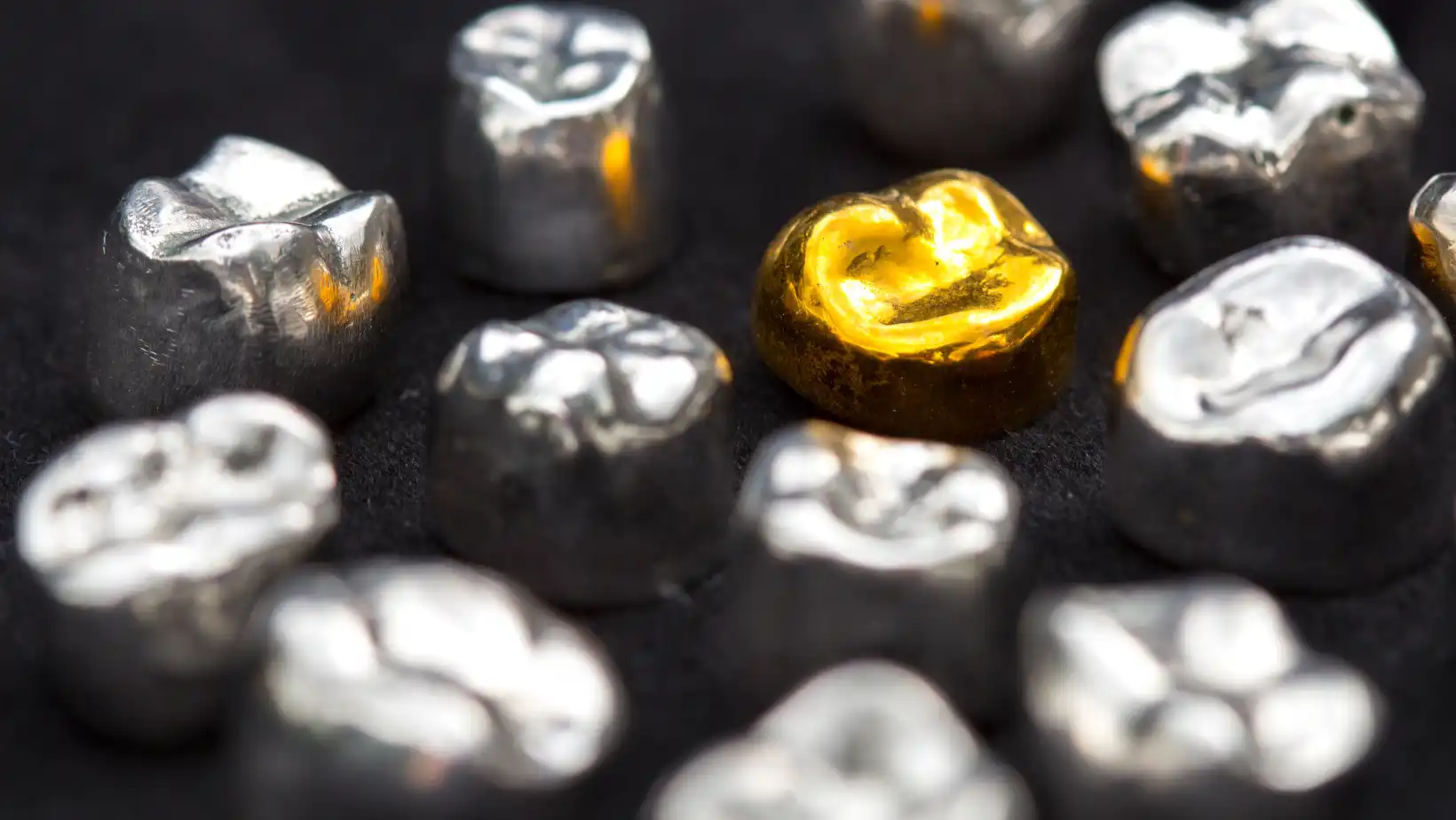 Gold and palladium dental crowns and fillings